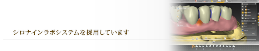 セルコンシステムを採用しています