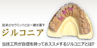 ジルコニア