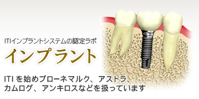 インプラント